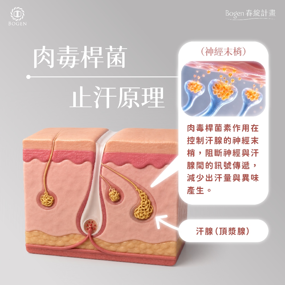 腋下止汗肉毒作用原理,腋下止汗,肉毒桿菌,博恩妍